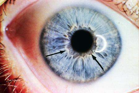 corso di iridologia a bologna immagine occhio 1