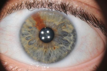corso di iridologia a bologna immagine occhio 2