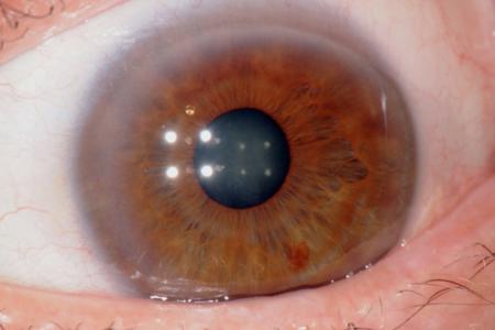 corso di iridologia a bologna immagine occhio 5