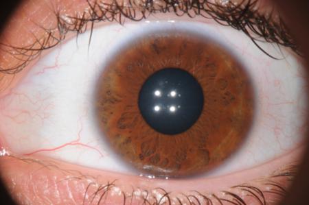 corso di iridologia a bologna immagine occhio 6