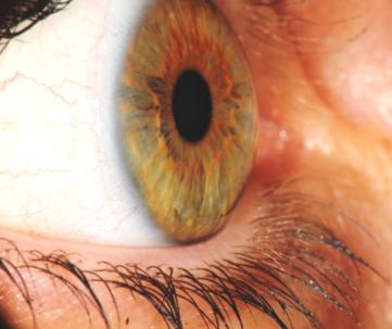 corso di iridologia a bologna immagine occhio 7